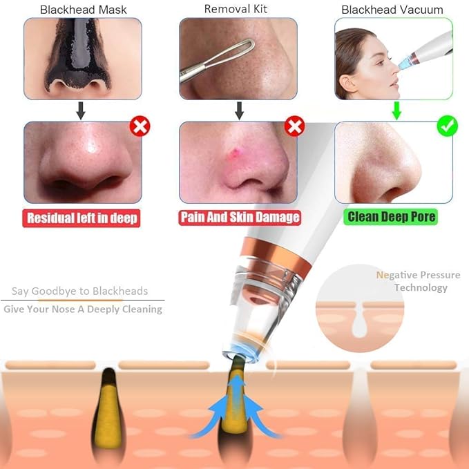 6-in-1 Blackhead Remover | USB Electric Facial Cleanser
